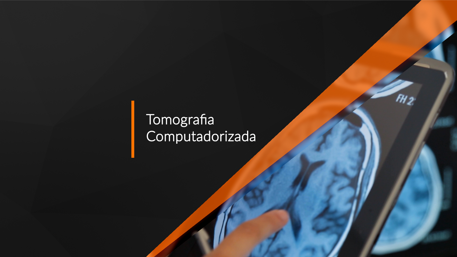 Tomografia Computadorizada