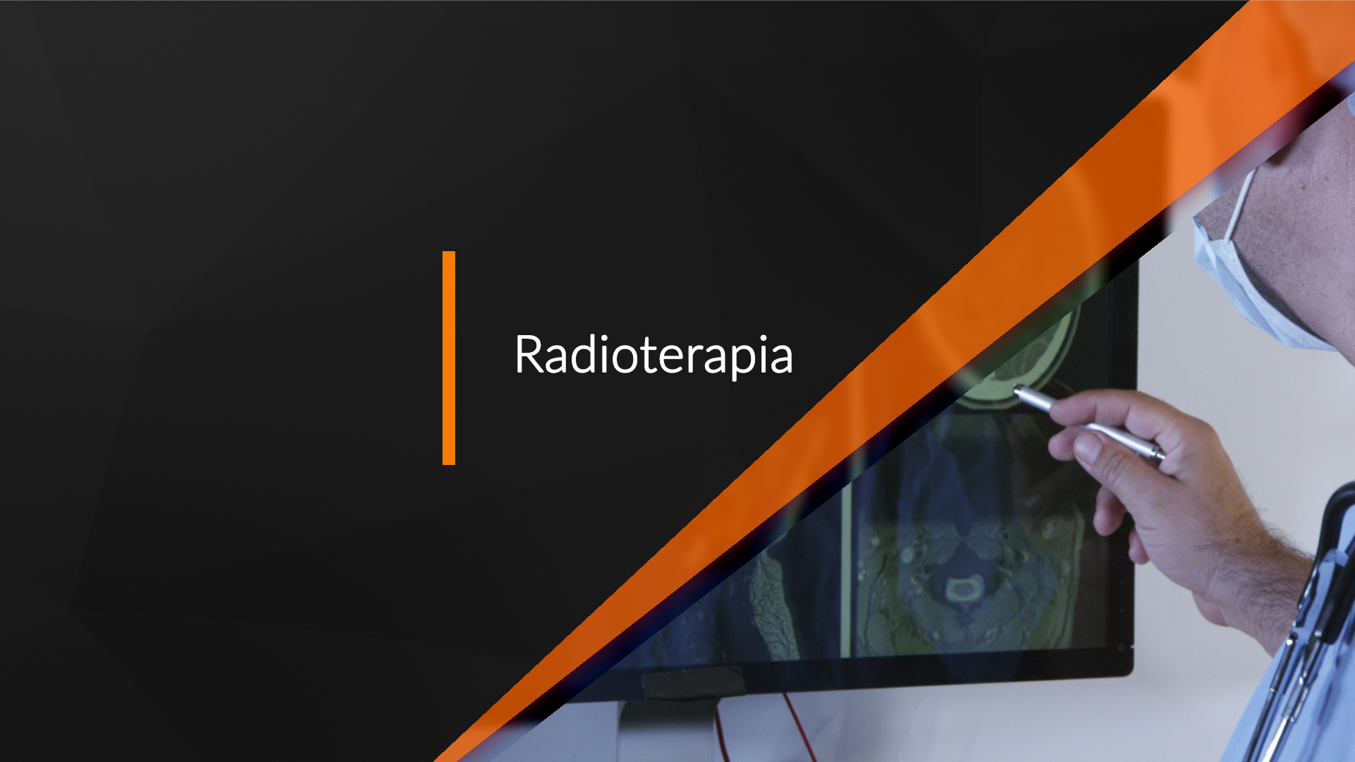 Radioterapia